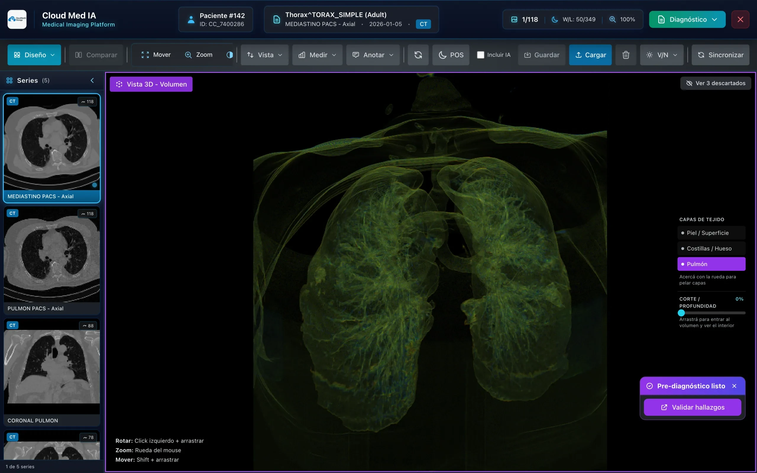 Visor DICOM de Med-IA renderizando un tórax en volumen 3D interactivo, con capas de tejido y la capa de pulmón resaltada